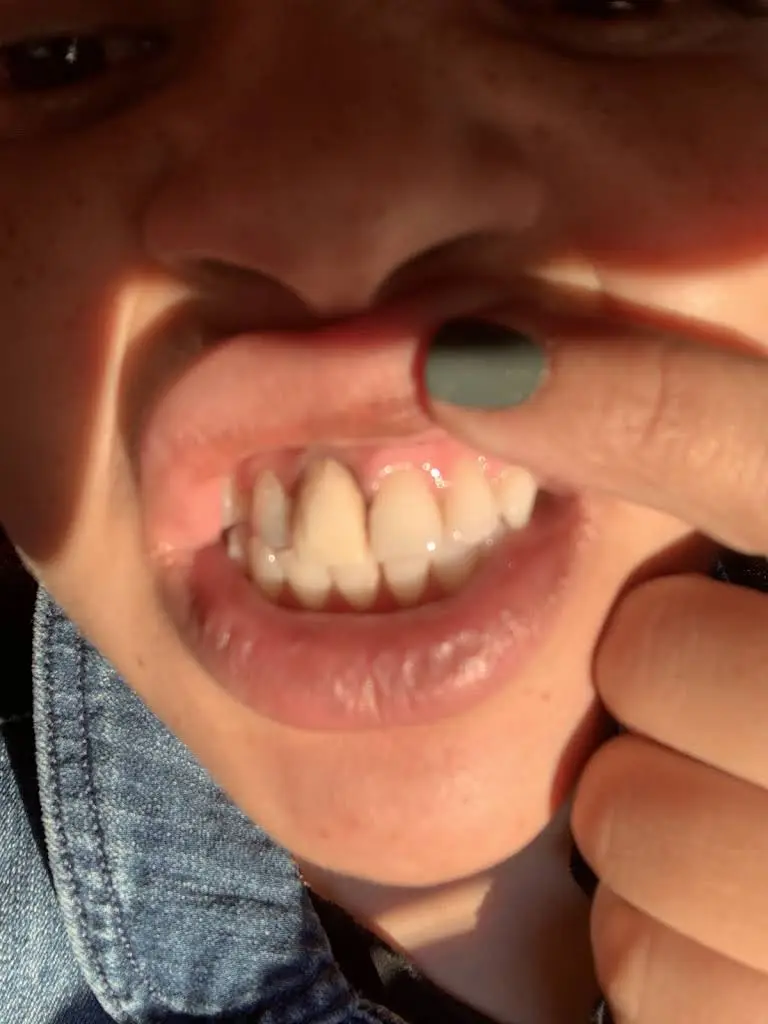 Sure Smile
