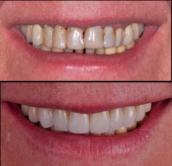 Smile Design Center of Westchester
