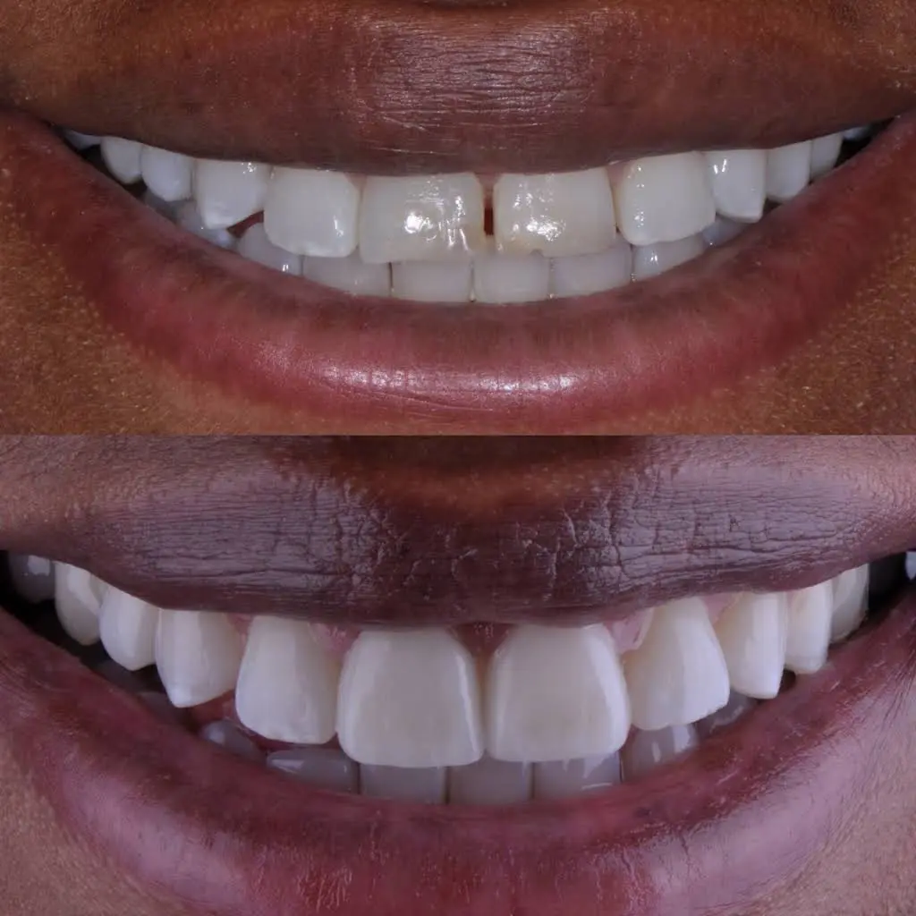 Smile Design Center of Westchester