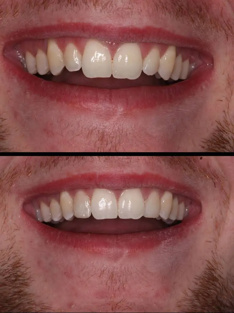 East Hills Dental Associates: Richard A. Sousa, DDS & Melody Ahdoot DDS