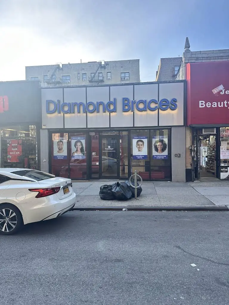 Diamond Braces