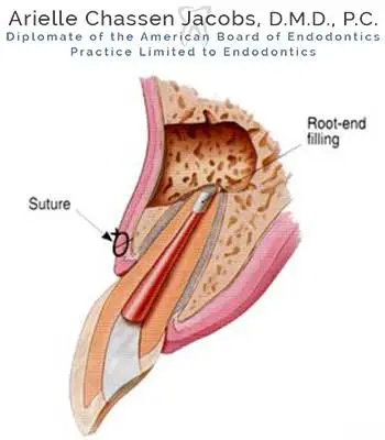 Scarsdale Endo Arielle Chassen Jacobs, D.M.D, P.C.