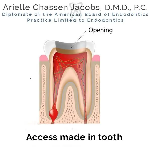 Scarsdale Endo Arielle Chassen Jacobs, D.M.D, P.C.