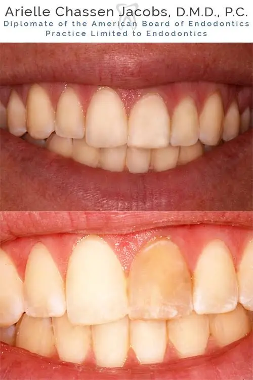 Scarsdale Endo Arielle Chassen Jacobs, D.M.D, P.C.