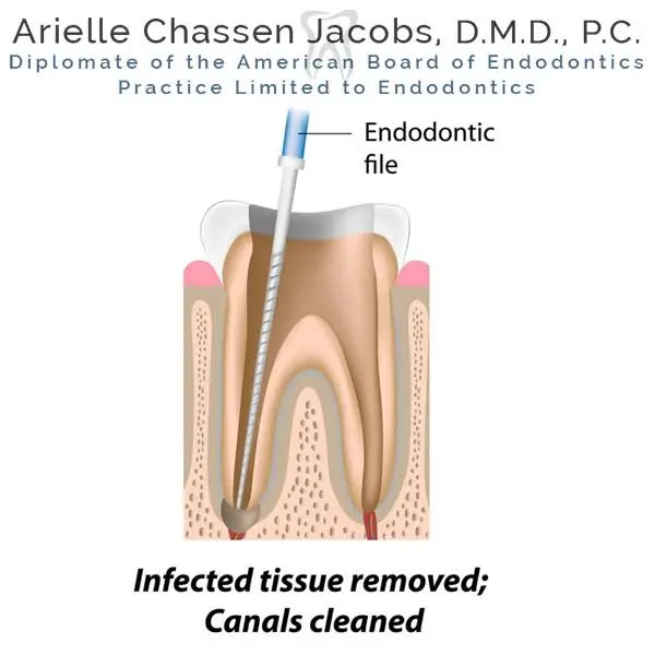 Scarsdale Endo Arielle Chassen Jacobs, D.M.D, P.C.