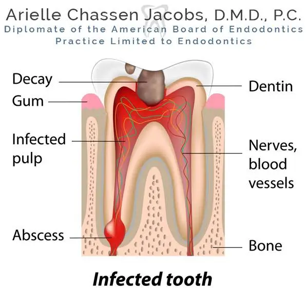 Scarsdale Endo Arielle Chassen Jacobs, D.M.D, P.C.