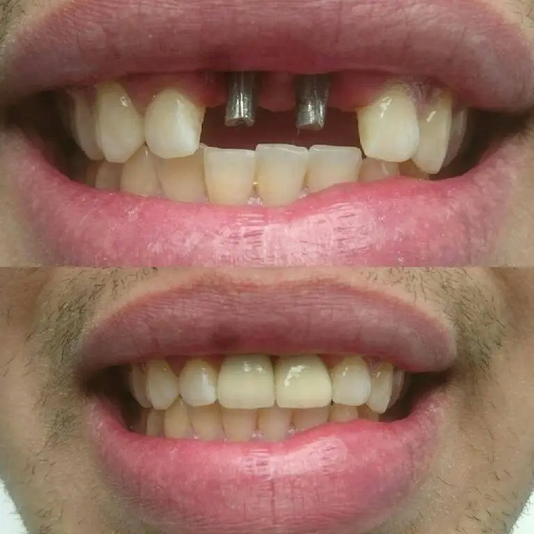 Cohen's Gentle Dental: Ofer Cohen, DDS