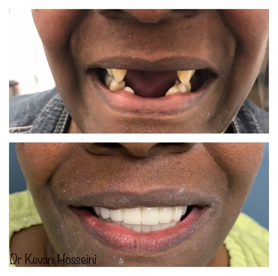 Cohen's Gentle Dental: Ofer Cohen, DDS