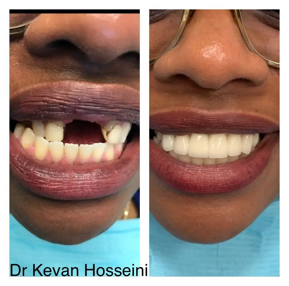 Cohen's Gentle Dental: Ofer Cohen, DDS