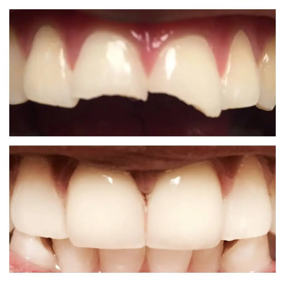 Cohen's Gentle Dental: Ofer Cohen, DDS