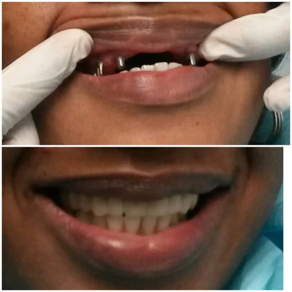 Cohen's Gentle Dental: Ofer Cohen, DDS