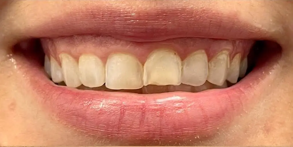 Fedele C. Vero, DDS and Alexei Bondarev, DDS