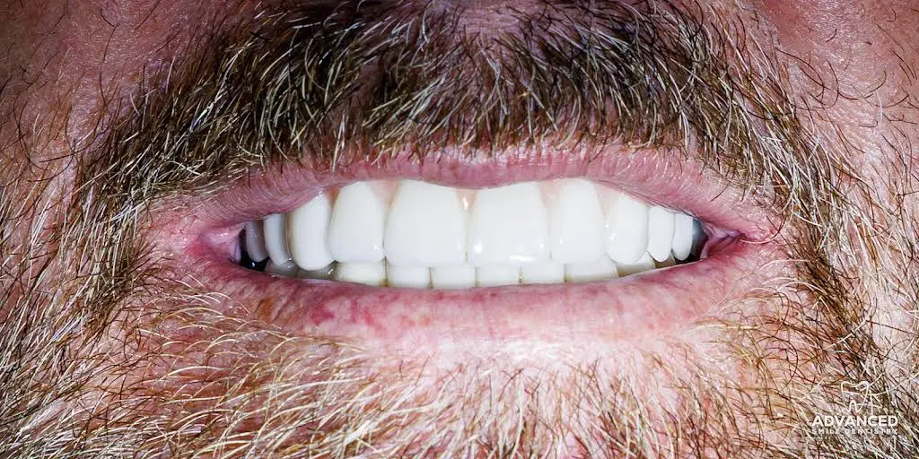 Advanced Smile Dentistry
