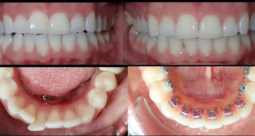 Shiney Smiles Orthodontics
