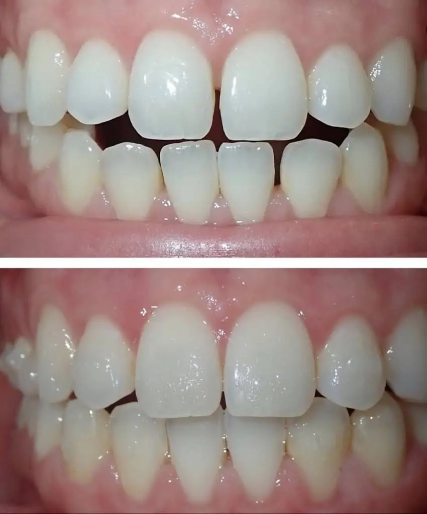 Shiney Smiles Orthodontics