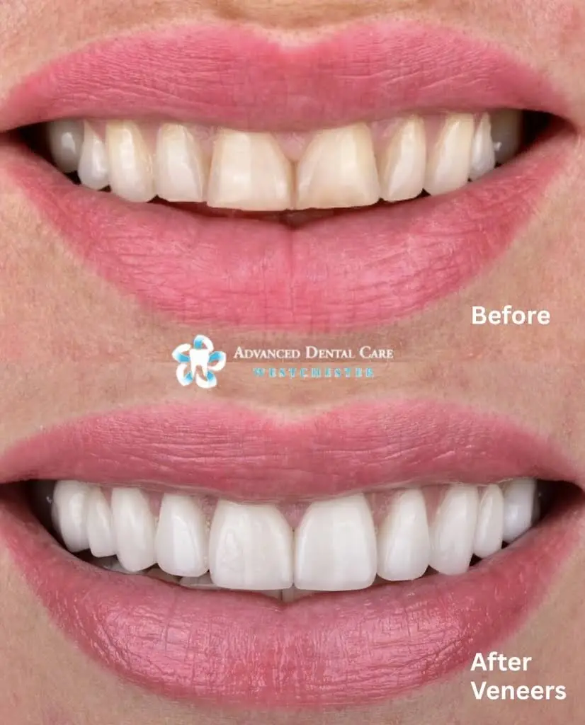 Advanced Dental Care of Westchester