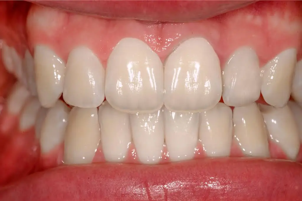 Center for Dental Excellence: Edward J Prus DDS - Professional dental clinic exterior with modern facilities