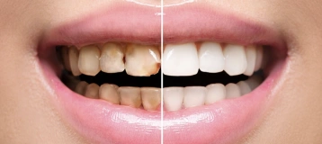 Westchester Dental Care