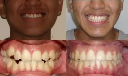 iCare Orthodontics