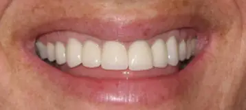 East Northport Dental Care