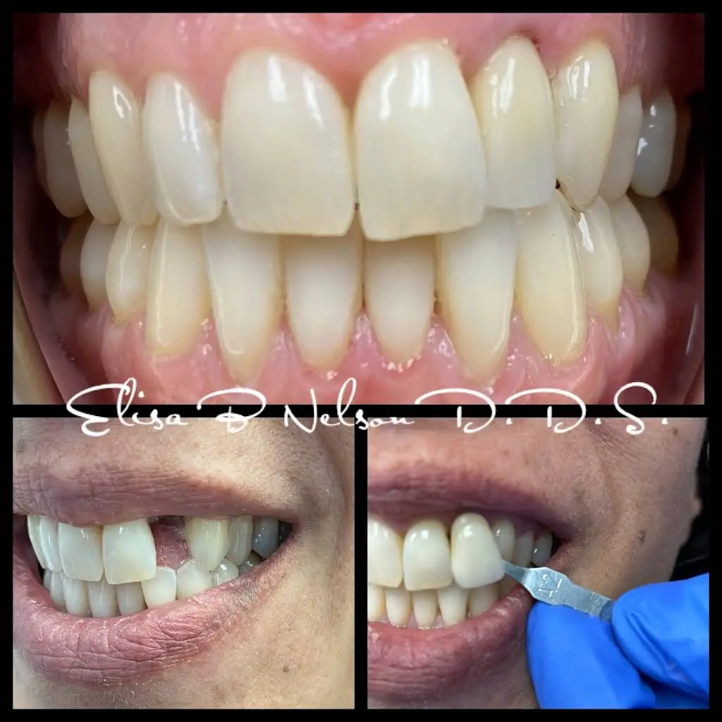 Elisa B Nelson, DDS, PC