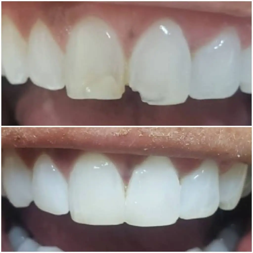 Baum Eric T DMD Emergency Dentistry
