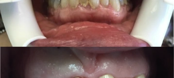 Commack Family Dental
