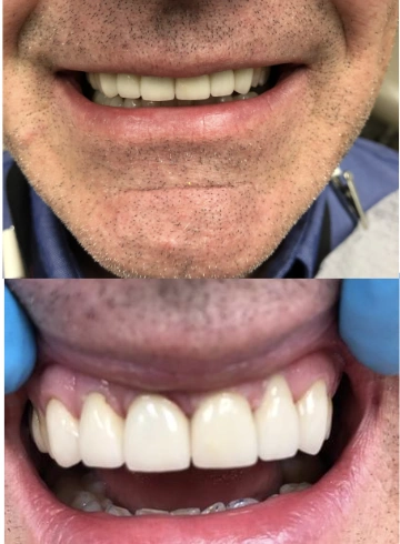 Commack Family Dental