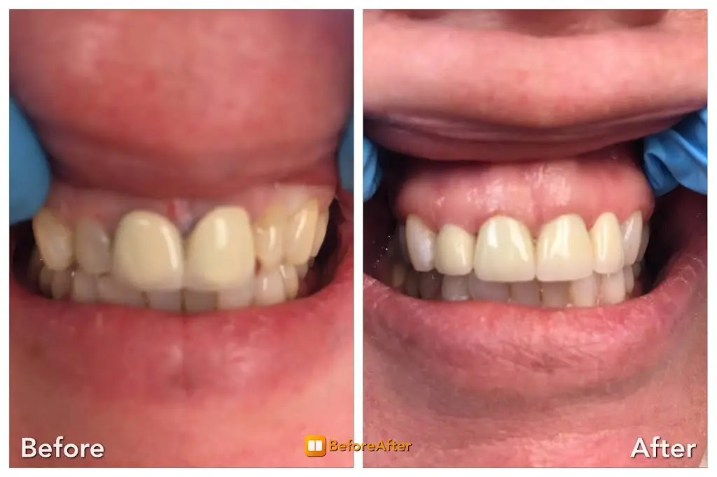 Commack Family Dental