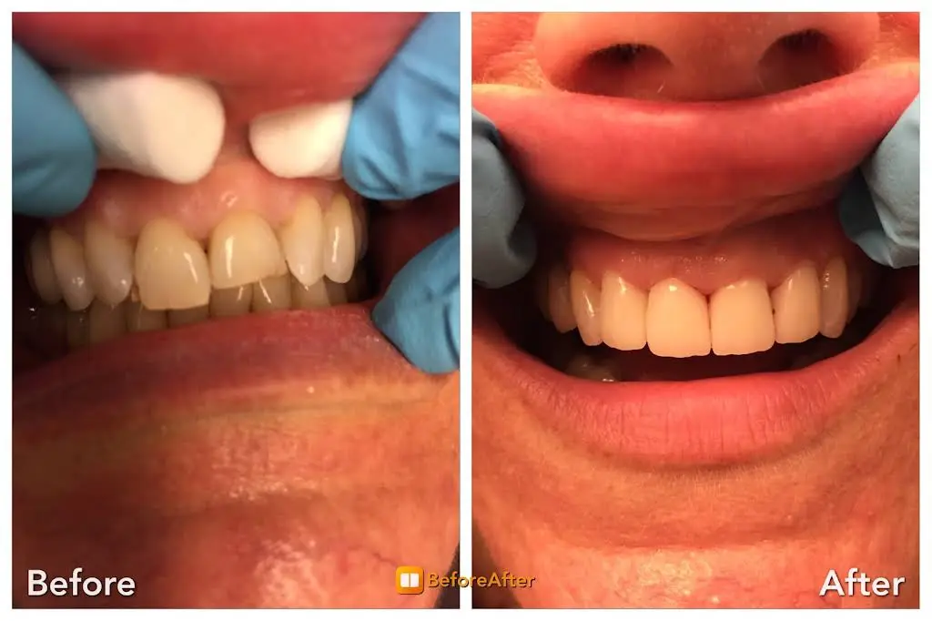 Commack Family Dental
