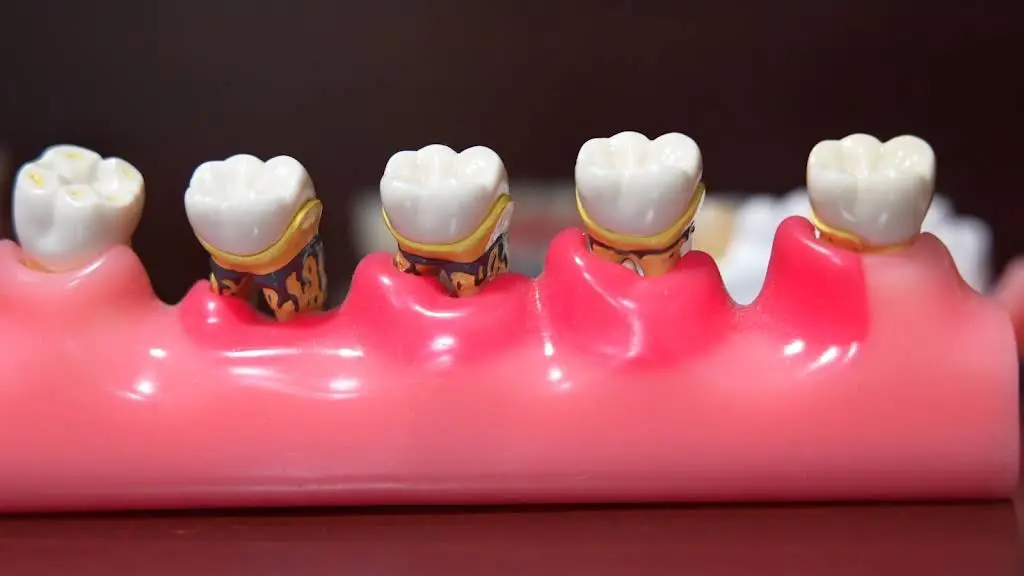 Helfner Dental Associates
