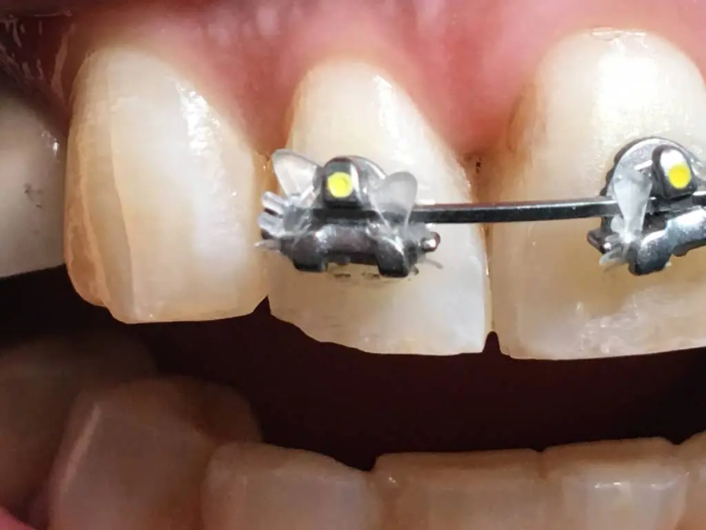 Oppenheimer Dentistry