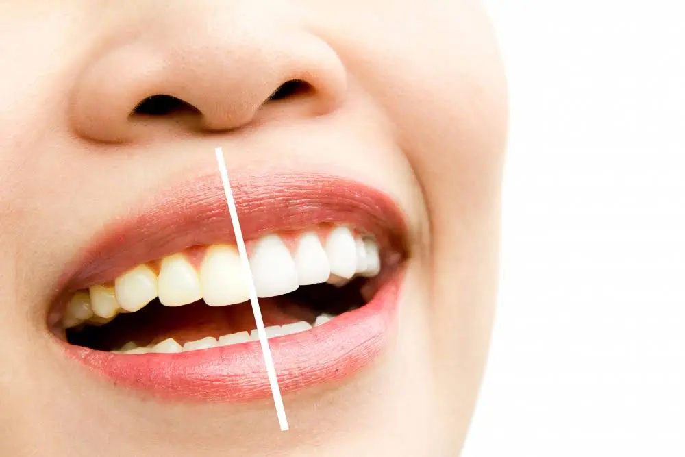 Aurora Smiles - Dr. Amul G. Patel, DDS P.C