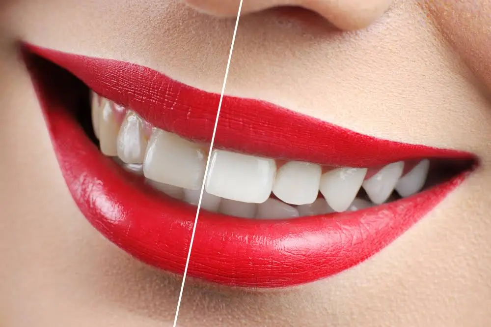 Aurora Smiles - Dr. Amul G. Patel, DDS P.C