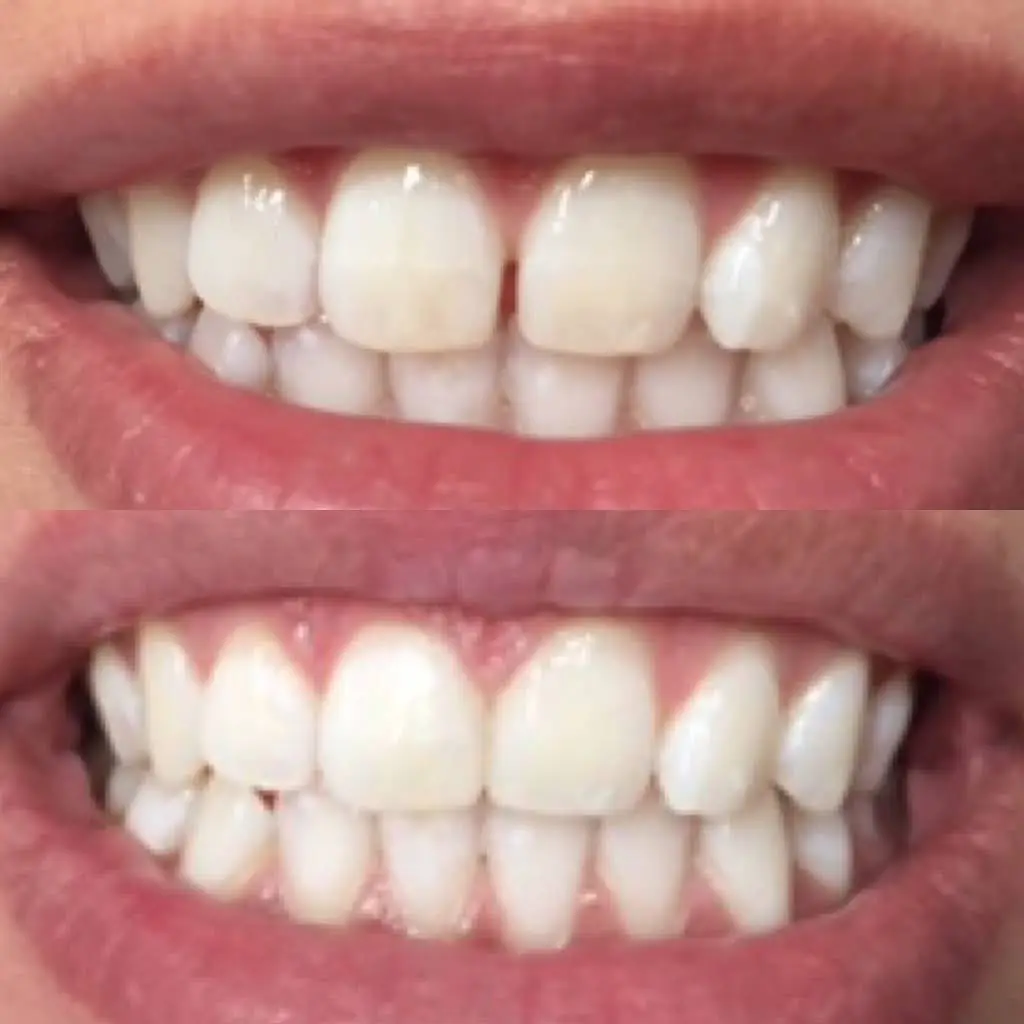 Simply Dental of Stamford