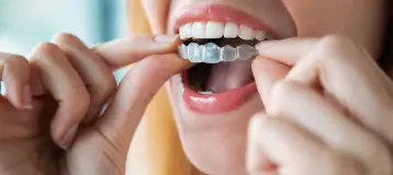 Frantastic Smiles / Fran Eichler DDS - General & Family Dentistry