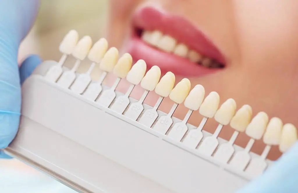 Frantastic Smiles / Fran Eichler DDS - General & Family Dentistry