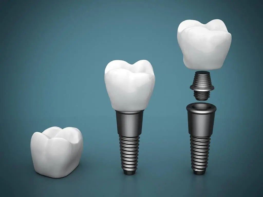 Frantastic Smiles / Fran Eichler DDS - General & Family Dentistry