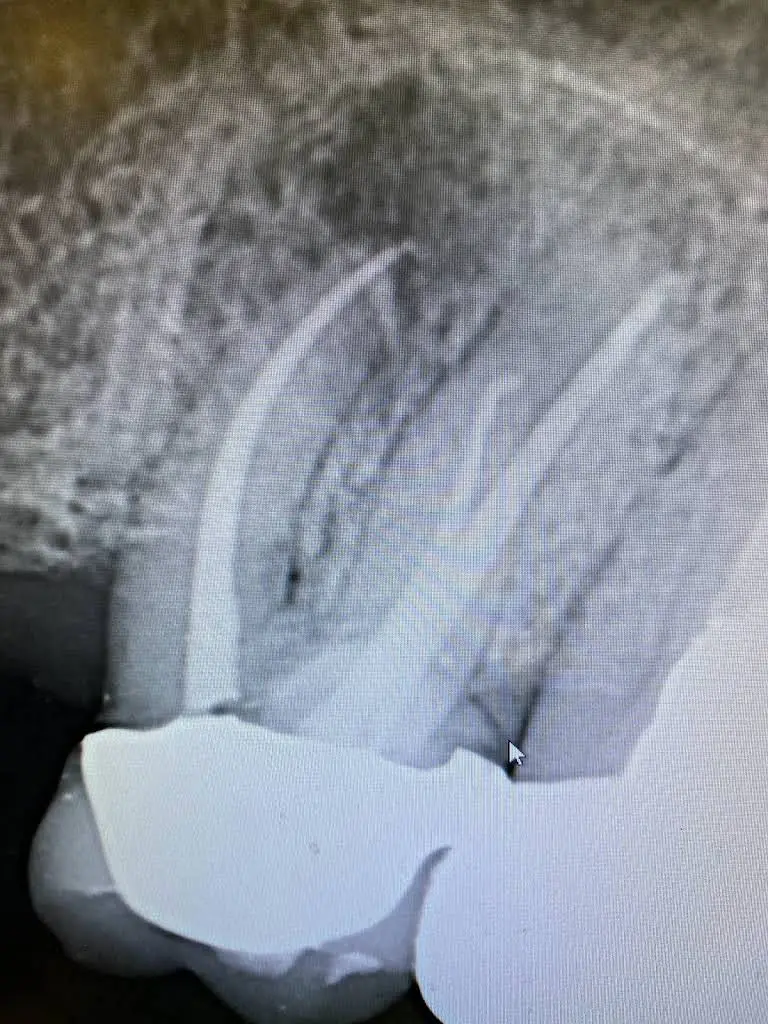 Hudson Valley Endodontics