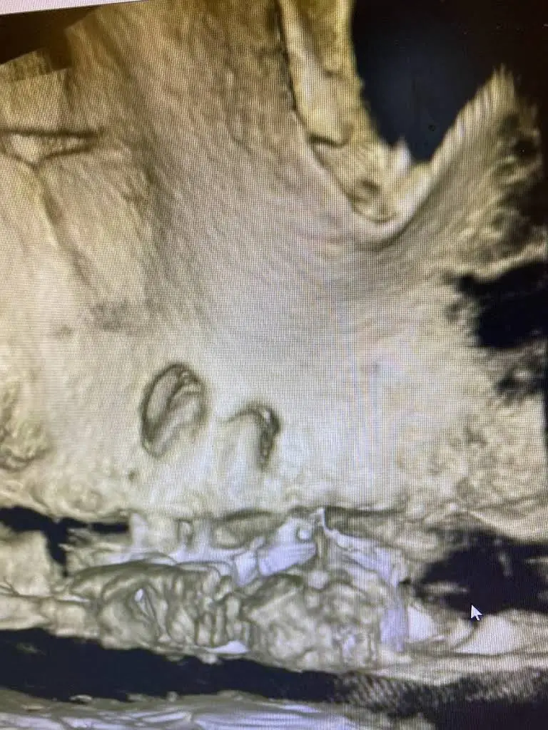 Hudson Valley Endodontics