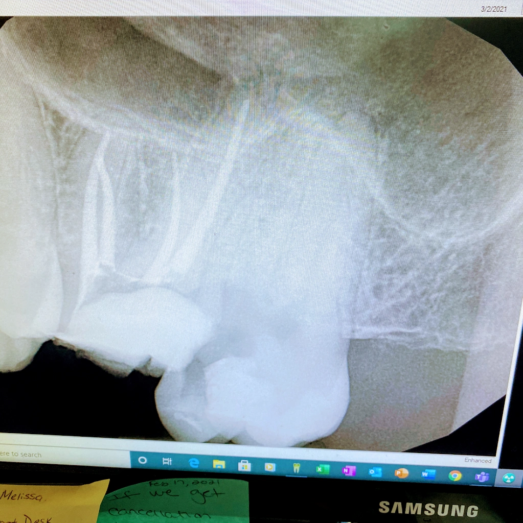 Hudson Valley Endodontics