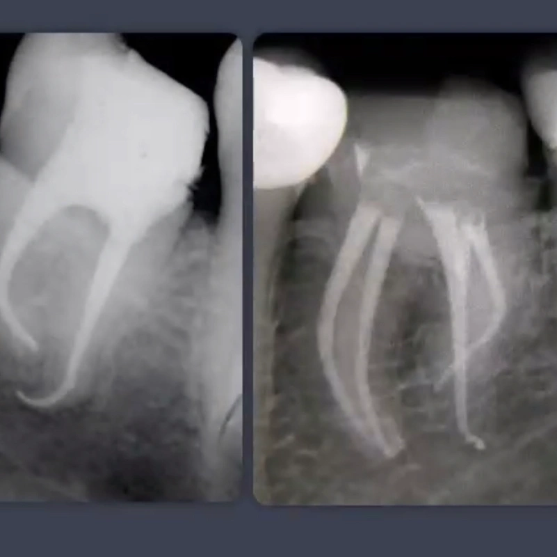Hudson Valley Endodontics