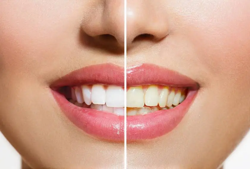 Brian L. Koppelman, DDS, P.C.