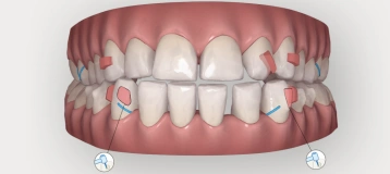 Bracetown Orthodontics