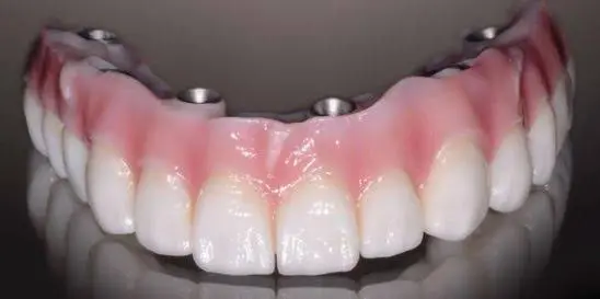Smile Center Family Dentistry
