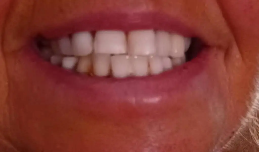 Great Expressions Dental Centers - Brookhaven