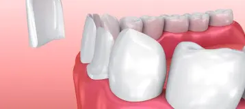Highland Family Dental