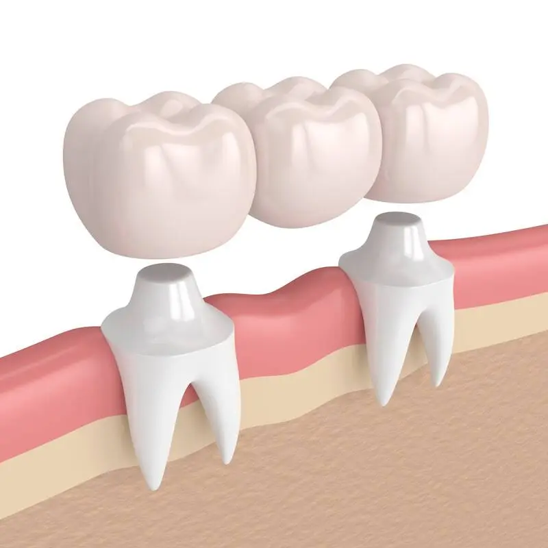 Highland Family Dental