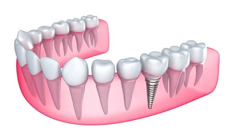 Highland Family Dental