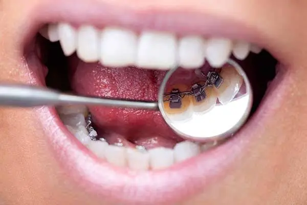Embrace Orthodontics